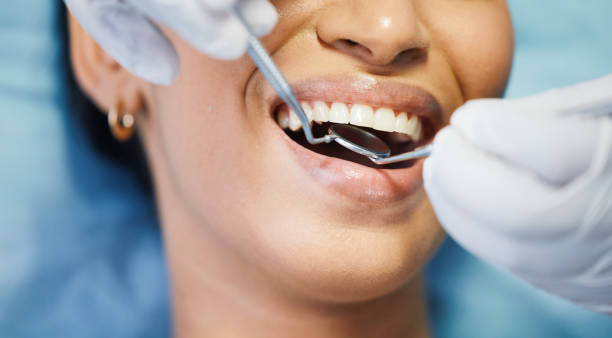 Best Emergency Gum Treatment in Downey, CA